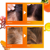 OMG! 3 in 1 Self Hair Clinic for Hair Restore